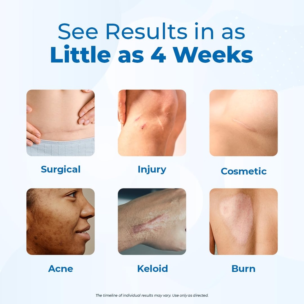 vitamedica-scar-gel-peptides-medical-gra-4.jpg