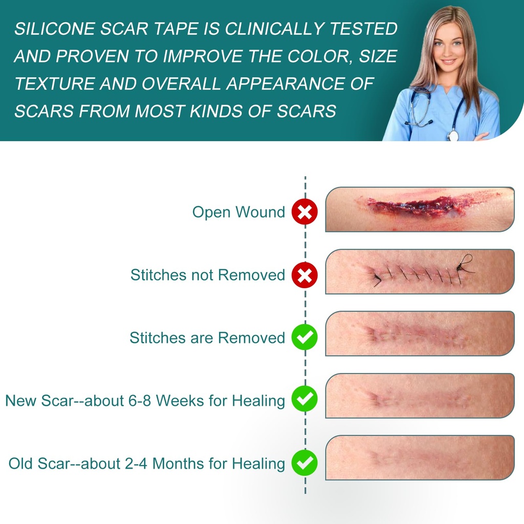 silicone-scar-sheets-1-6-x-158-roll-4m-m-715zJOQa+XL.jpg