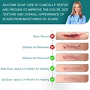 silicone-scar-sheets-1-6-x-158-roll-4m-m-715zJOQa+XL.jpg
