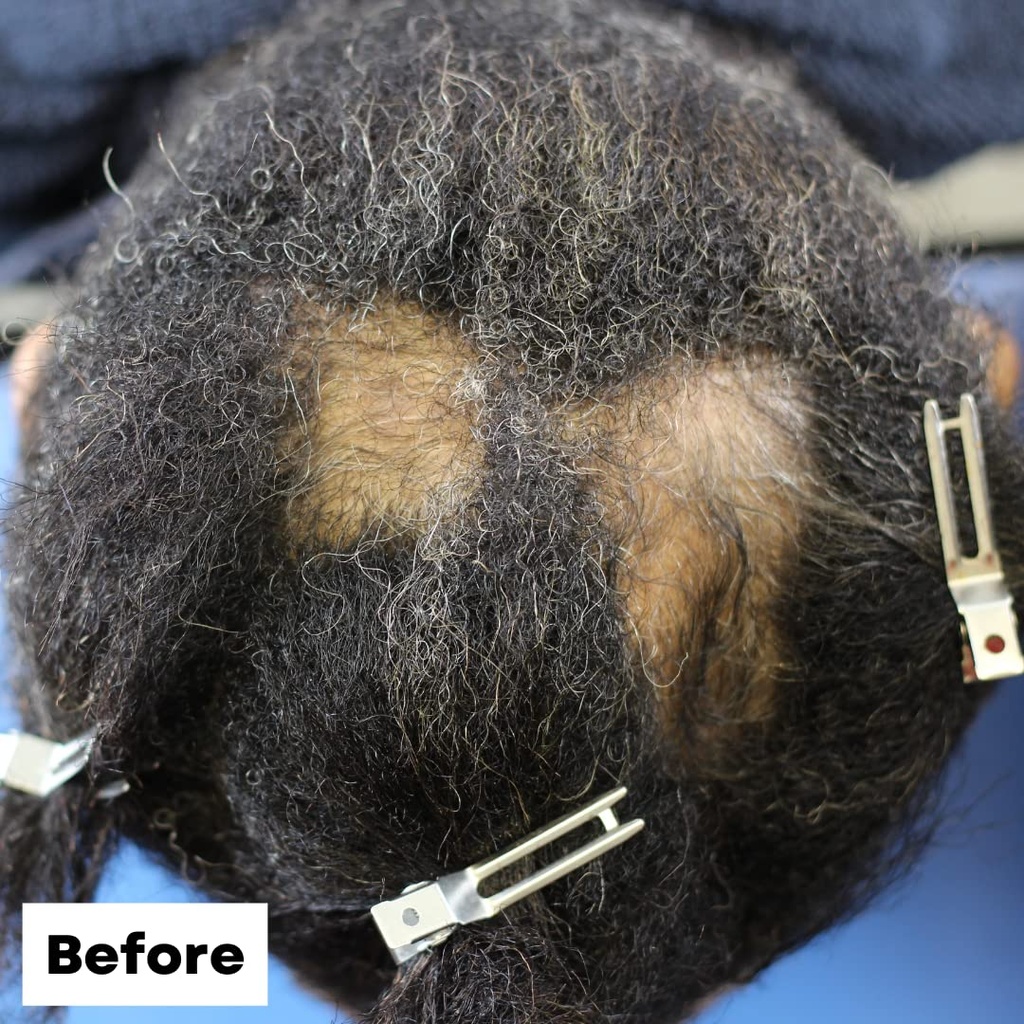 as-i-am-hair-spray-rice-water-16oz---wit-4.jpg