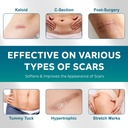 silicone-scar-sheets-silicone-scar-tape1-3.jpg
