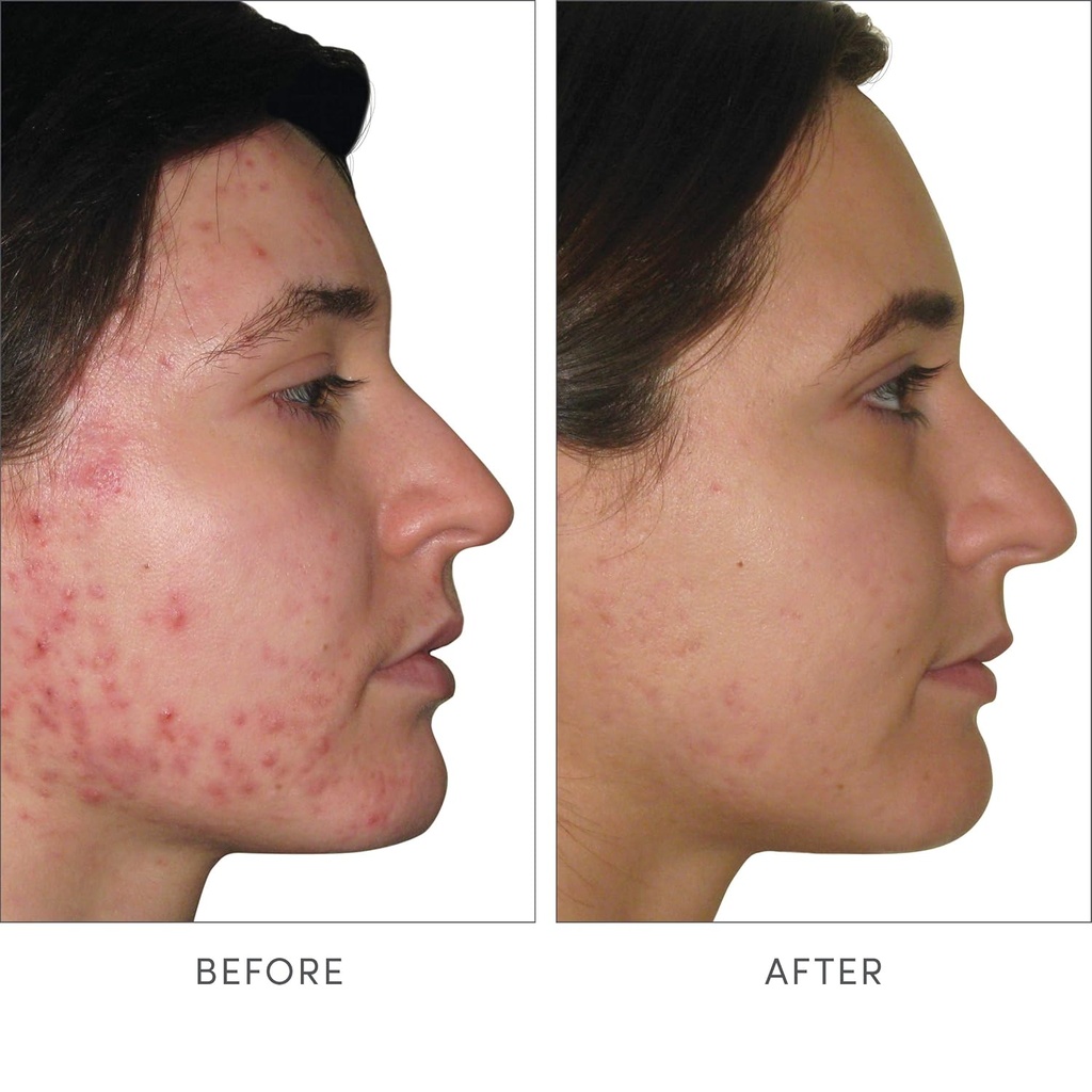 jane-iredale-skin-accumax-nutritional-su-3.jpg