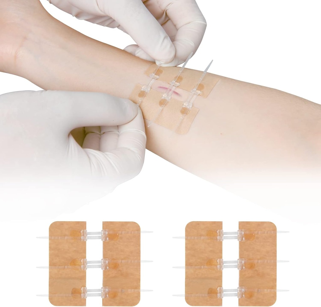 Zip Stitch Laceration Opravy bez Stitches Butterfly Bandaides Quick Clot - Nouzové zranění Closhes Device 2 Kusy PU