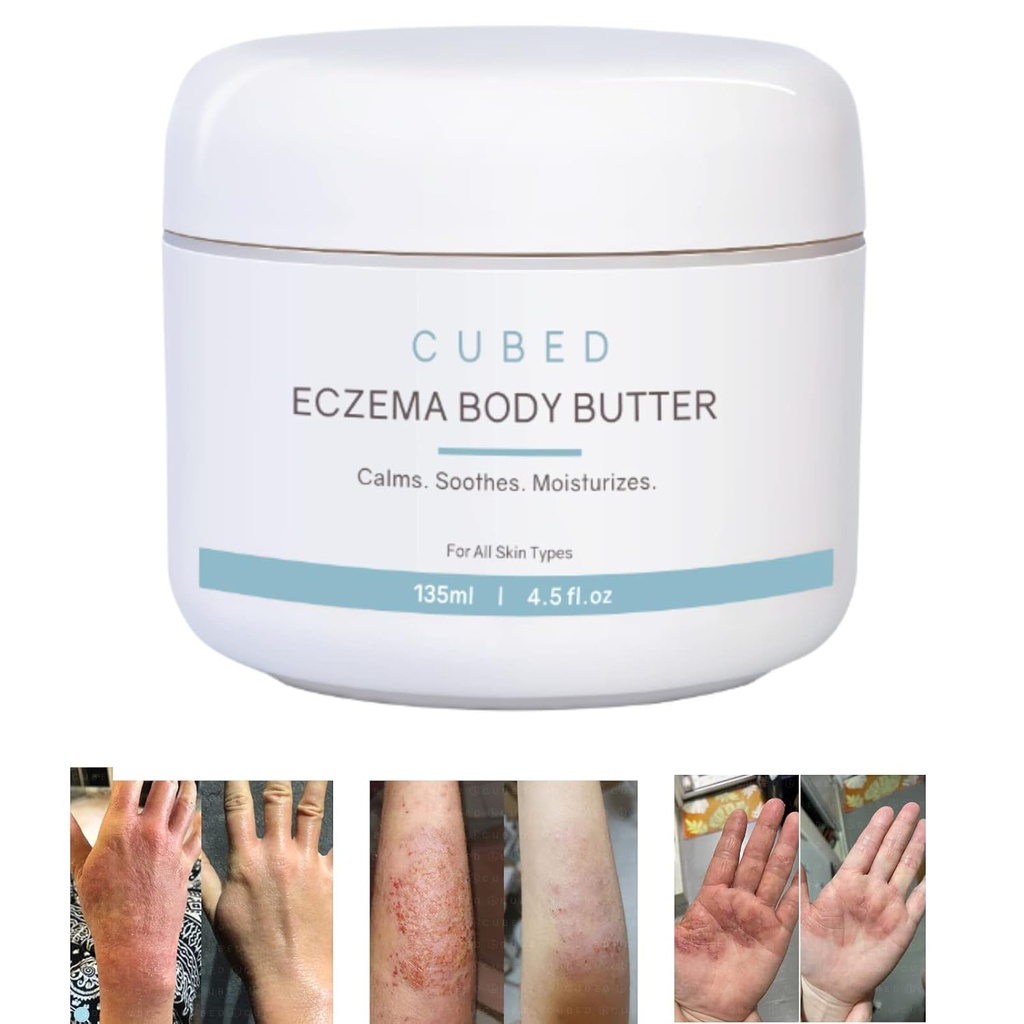 Cubed 4,5 oz Eczema krém pro dospělé, Eczema Relief, Eczema Léčba, Moisturized Suchý zavlažovaná kůže, Chytrý krém pro Topical Steroid abstinenční příznaky, Psoriáza & Rosacea, Eczema, Dermatitida