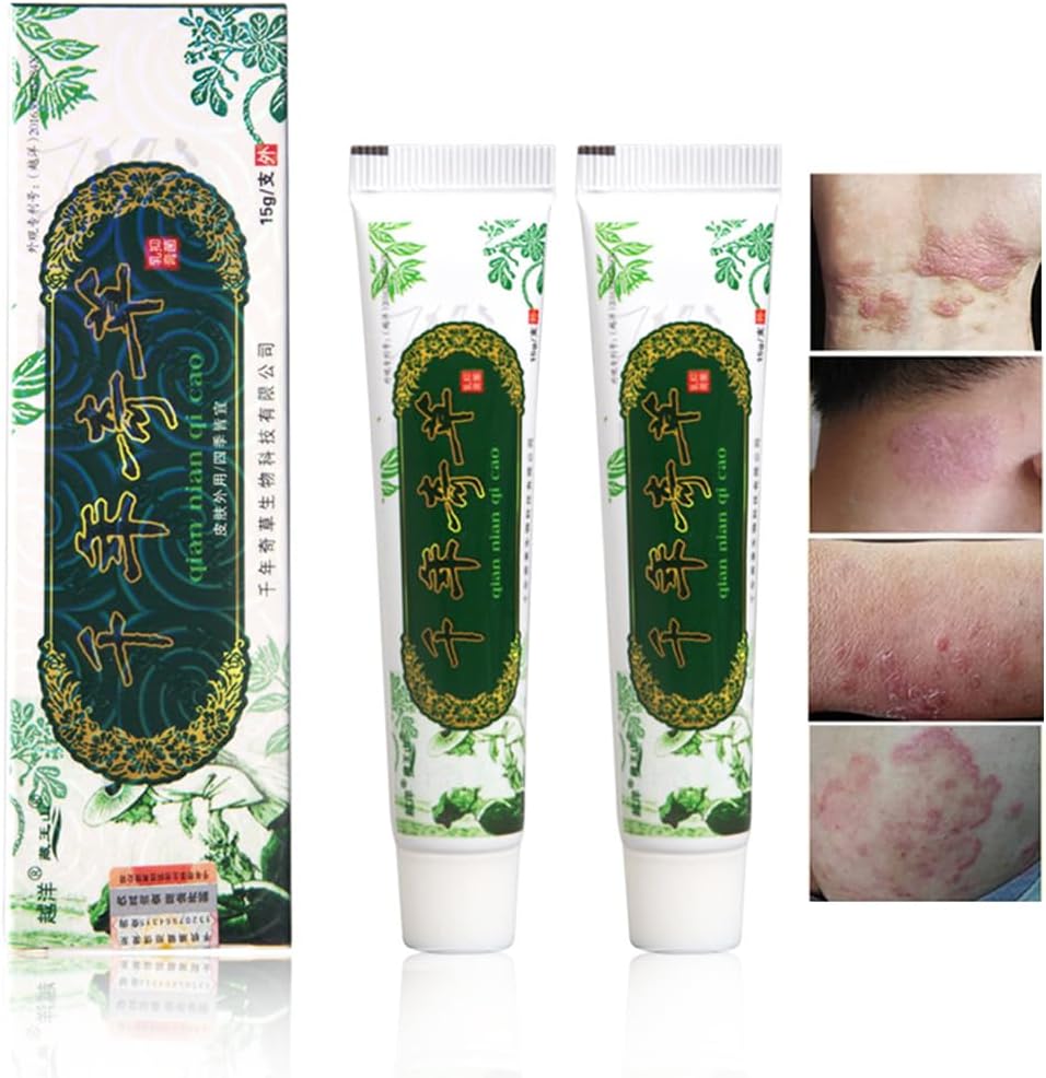 Oversea tisíc-rok Bylinný krém čínské Bylinné Eczema, Psoriasis Creams Dermatitis a Eczema Pruritus Psoriasis JIULIN Ointment (2PCS)