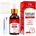 Toe Nail Fungus Léčba pro nehty na nehty: Nail Fungus Léčba na nehty - Extra síla, Fast- působící řešení pro prasklé, poškozené, zbarvené nehty