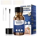 Toenail Fungus Léčba, Foot Fungus Léčba Extra Síla, Fungus Léčba nehtů, Toe Nail Fungus léčby pro houby Nail žlutá nehtová léčba (1fl oz / 30ml)