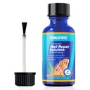 Toenail Fungus Léčba Extra Síla - Nail Fungus Léčba pro nehty - Toe Nail Fungus Léčba Extra Síla - Nail Fungus Léčba (30 ml)