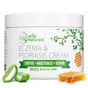Wild Naturals Eczema & Psoriasis Cream for Dry, Itchy Skin - Eczema Relief for Dospělí & Kids - Moisturising Psoriasis Cream with Manuka Honey - Hydratační med Lotion for Hands and Face