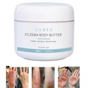 Cubed 4,5 oz Eczema krém pro dospělé, Eczema Relief, Eczema Léčba, Moisturized Suchý zavlažovaná kůže, Chytrý krém pro Topical Steroid abstinenční příznaky, Psoriáza & Rosacea, Eczema, Dermatitida