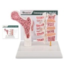Ultraassist Human Anatomy Osteoporóza Model, Vertebrae Anatomical Skeleton Model se studijním průkazem pro lékařské studenty Demonstrace