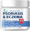 Biologicko-MD Psoriáza Eczema Cream, Eczema Cream pro dospělé, Extra Control Recidence, Relieve Symptomy rezistence, Efektivní pro Seborrheic Dermatitida, Follikulitida Léčba