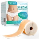 Silikonové Jiskry, Silikonové Jiskry Páska, Silikonové Prostěradla pro Jizvy, Jizvy pryč Silikonové Jizvy Prostěradla pro Tvář, Akné, Keloid, Burns, Stretch Mark, C-Section Chirurgické Jizvy Odstranění (1.6 "x 60" Roll-1.5M)
