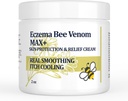 Vysoká síla Bee Venom Cream, Dyshidrotic Eczema Ointment, Heat Rash, Svědění, Eczema, Psoriáza, Noha, Žaludek, Noha, Noha, Ruka, Podrážděná kůže, Všechny věk péče