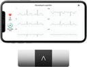AliveCor KardiaMobile 6- Olovo Osobní EKG Monitor - Six Views of The Heart - Detects AFib a Nepravidelné Arytmie - Okamžité výsledky za 30 sekund - Pracuje s Most Smartphone