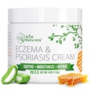 Wild Naturals Eczema & Psoriasis Cream for Dry, Itchy Skin - Eczema Relief pro dospělé a děti - Moisturizace Psoriasis Cream with Manuka Honey
