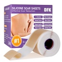 Silikonové Jiskry, Silikonové Jiskry Tape (1.6 "x 79" Roll-2M), Reaktivní Jiskry Silikonové pruhy, Měkké Silikonové Jiskry Prostěradla pro chirurgické Jizvy, Keloid, Akné Jizvy, Spálené Jizvy, C-Section