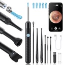 Loyker X6 odstraňovač uší, čistič uší s fotoaparátem, FSA - HSA Store způsobilých, 1080P Ušní kamera s 6LED světlem pro uši / nos / hrdlo / Tonsil Stone Examination, černá